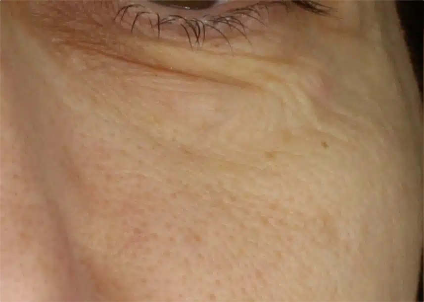 Close-up of human eye with natural skin texture.