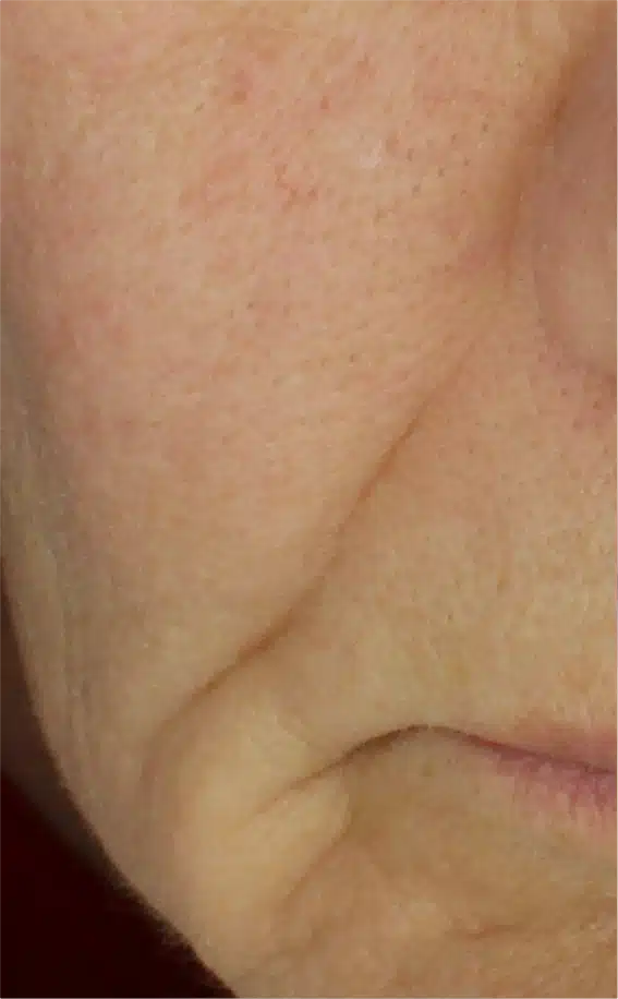 Close-up of mature skin with visible pores and wrinkles.